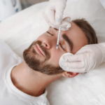 Botox & Fillers Near Me_Bala Medi Spa