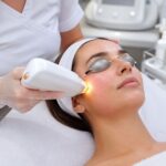 Dye VL IPL treatment for pigmentation and redness using light therapy device for clearer and even skin tone