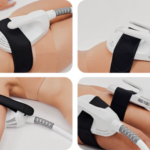 EMShape Treatment Bel Air MD_Bala Medi Spa