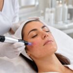 Microneedling for skin rejuvenation in Bel Air MD using dermapen device to improve skin texture and collagen