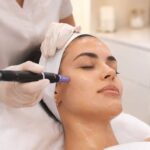 Microneedling with PDRN for summer skin maintenance to support collagen production and healthy glowing skin