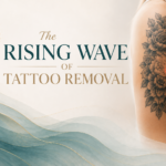 Tattoo Removal_Bala Med Spa
