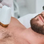 Laser Hair Removal_Bala Aesthetics & Medispa