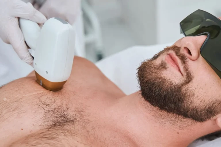 Laser Hair Removal_Bala Aesthetics & Medispa
