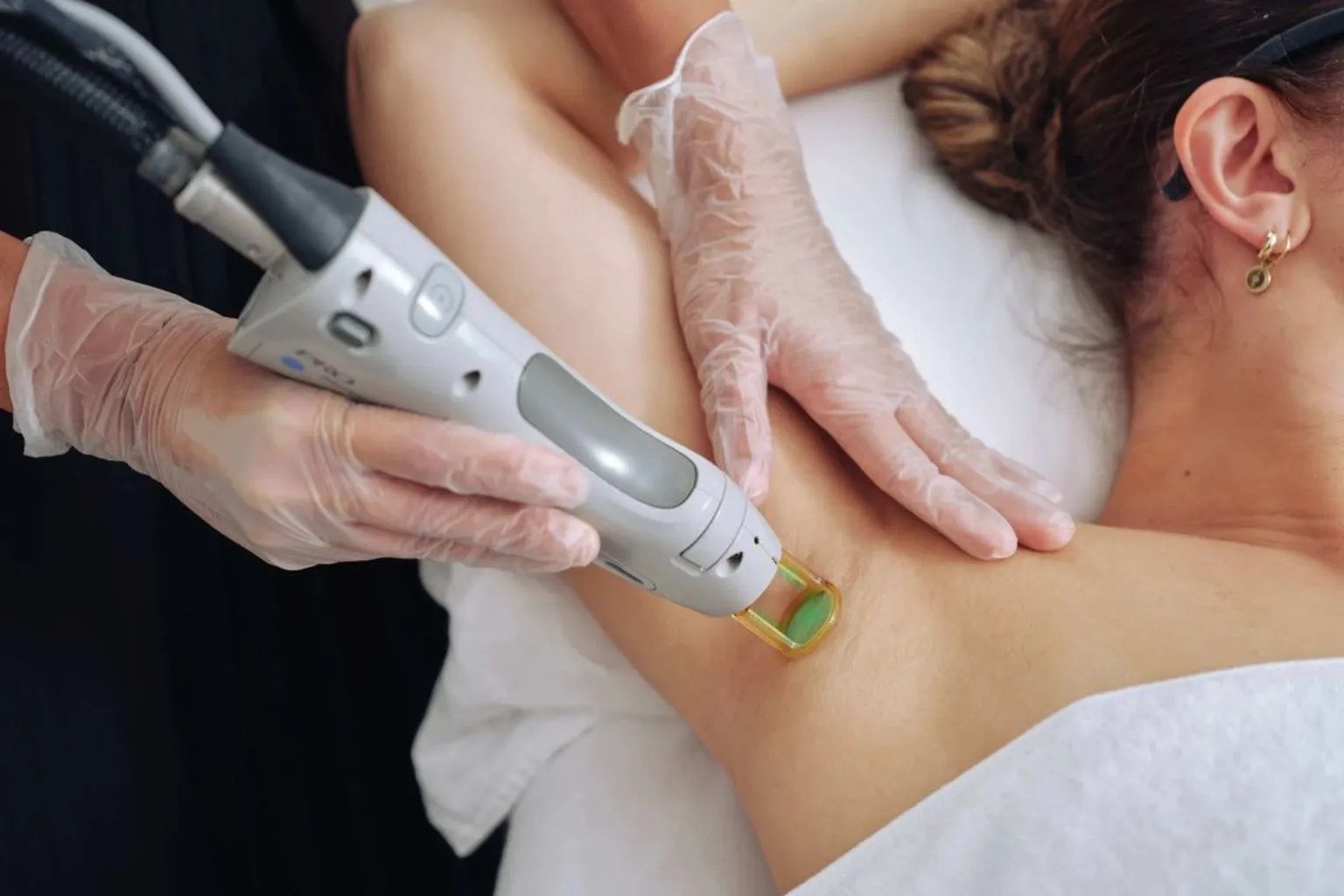 Why Fall Is The Best Time To Start Laser Hair Removal In Maryland ?_Bala Aesthetics & Medispa
