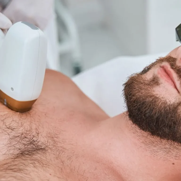 Laser Hair Removal_Bala Aesthetics & Medispa